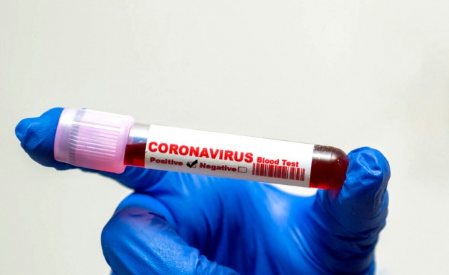Corona virüs tanısında etkili yöntem